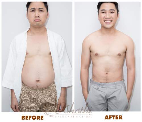 Bí quyết giảm 5kg một tuần của Don Nguyễn 6