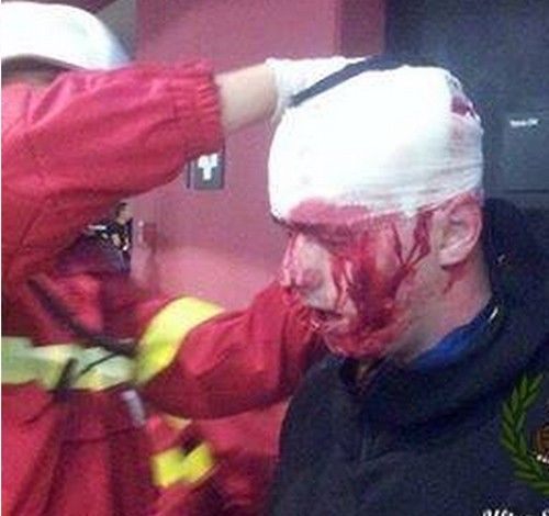 Bạo lực kinh hoàng trong trận đấu vòng loại EURO 6