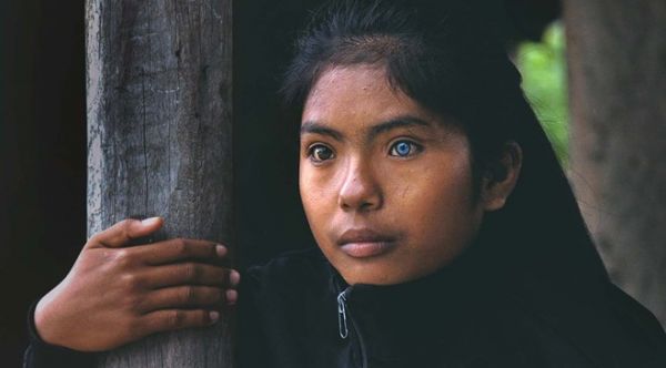 Cô gái có đôi mắt hai màu kỳ lạ ở Ninh Thuận 5