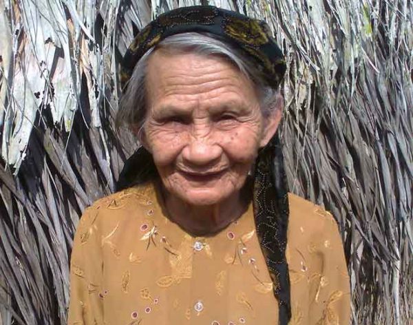 Cụ bà 82 tuổi bị ong đốt hơn 100 nốt vẫn sống 3