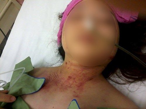 Một phụ nữ Việt bị cướp và cưỡng hiếp ở Malaysia 2