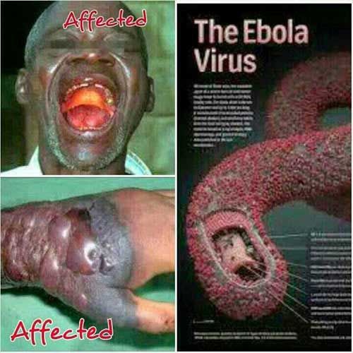 Lời tiên tri đáng sợ về bệnh Ebola của Vanga năm 2014 3