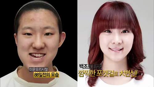 Thiếu nữ Hàn Quốc xinh đẹp hơn nhờ căn chỉnh mặt lệch 7