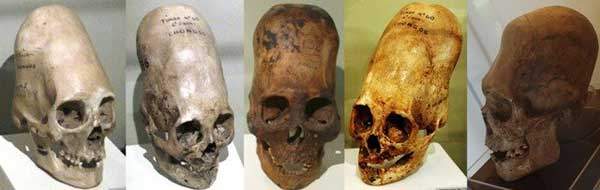 Hộp sọ bí ẩn Paracas không phải ADN của người 2