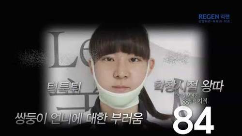 Thiếu nữ Hàn Quốc xinh đẹp hơn nhờ căn chỉnh mặt lệch 6