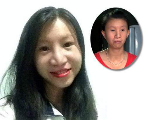 So độ "lột xác" của 10 thiếu nữ Việt sau dao kéo 30