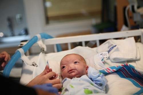 Video: Hy hữu cậu bé sinh ra không có mũi 5