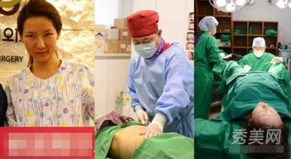 Trào lưu công khai ảnh phẫu thuật thẩm mỹ của sao Hoa ngữ 7
