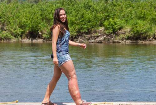 Video: Cô gái có chân phải khổng lồ trở thành hoa hậu 5