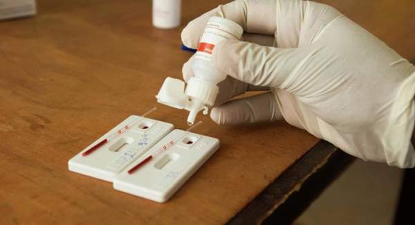 Tìm ra loại thuốc có khả năng “diệt tận gốc” HIV 2