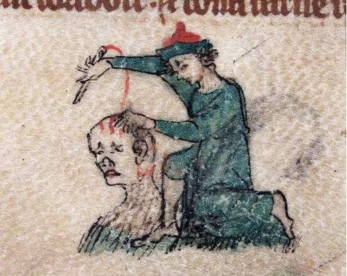 Những cách chữa bệnh đáng sợ thời Trung Cổ 2