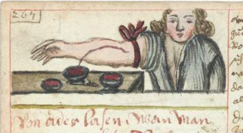 Những cách chữa bệnh đáng sợ thời Trung Cổ 4