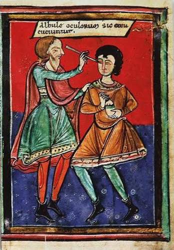 Những cách chữa bệnh đáng sợ thời Trung Cổ 3
