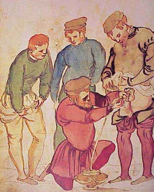 Những cách chữa bệnh đáng sợ thời Trung Cổ 6
