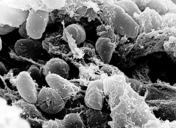 Vi khuẩn tưởng chừng vô hại này đã giết hại 1/3 dân số thế giới ngày trước 2
