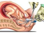 7 lý do mẹ bầu nên ăn quả óc chó mỗi ngày 4