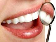 Cách làm trắng răng tại nhà đơn giản mà siêu hiệu quả 16