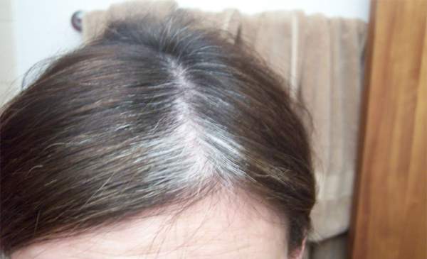 7 lợi ích của Vitamin E với tóc không phải ai cũng biết 9