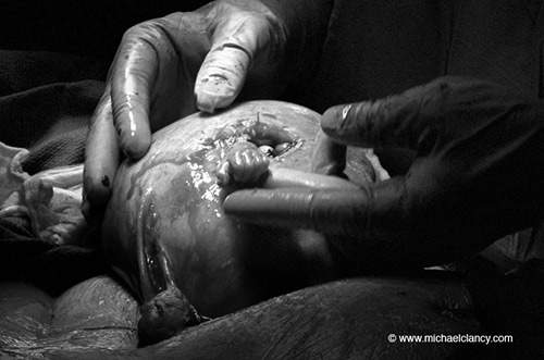 Gặp lại thai nhi trong bức ảnh nắm ngón tay bác sỹ chấn động thế giới 3