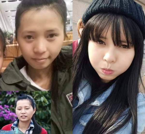 Bất ngờ với nụ cười đẹp của 2 cô gái Việt từng sứt môi 4