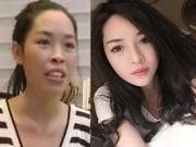 Xót xa cô gái Quảng Ninh phải cắt bỏ môi sau khi tiêm chất làm đầy 11