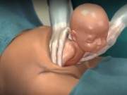 Vị trí nằm hiếm gặp của thai nhi 3 tháng khiến mẹ bầu ‘chết lặng’ 14