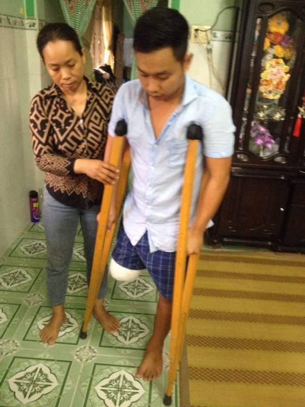 Bệnh nhân bị cưa chân sau chẩn đoán “vết thương phần mềm” 2