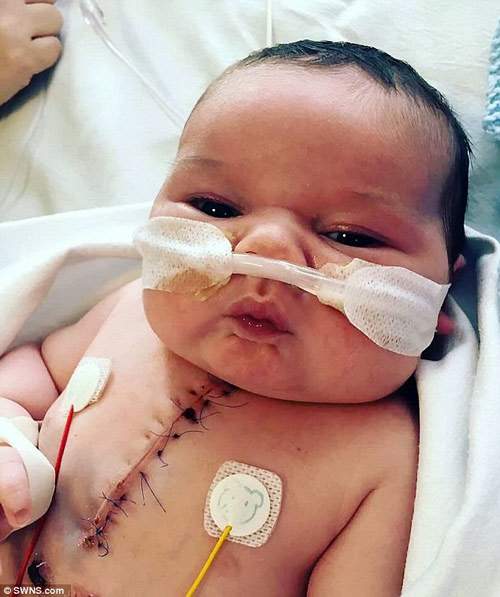 Sinh ra chỉ với nửa trái tim, em bé này chính là "chiến binh vô cùng mạnh mẽ" 3