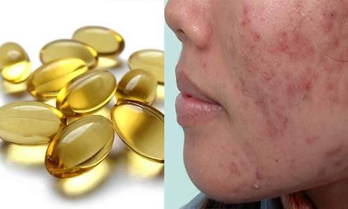 99% chị em sẽ mua Vitamin E ngay khi biết được những điều này 9