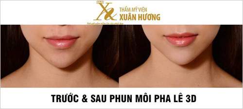 Tuyệt chiêu đánh bật môi thâm, môi khô nứt nẻ trong mùa đông. 12