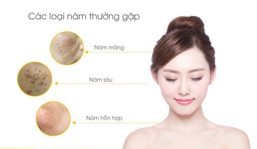 Làm sao sạch nám sáng da, đón đầu vận may mừng năm mới?. 9