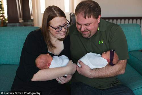 Nhói tim với ảnh em bé đang cận kề cái chết ôm chị gái song sinh vừa chào đời 33