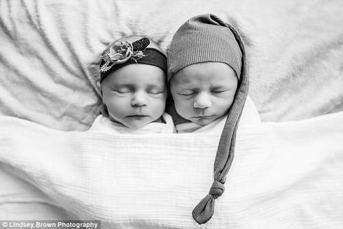 Nhói tim với ảnh em bé đang cận kề cái chết ôm chị gái song sinh vừa chào đời 24