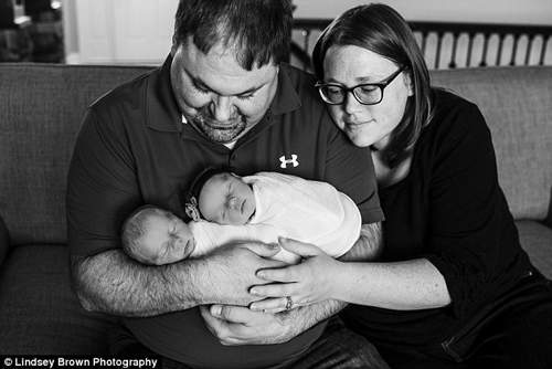 Nhói tim với ảnh em bé đang cận kề cái chết ôm chị gái song sinh vừa chào đời 39