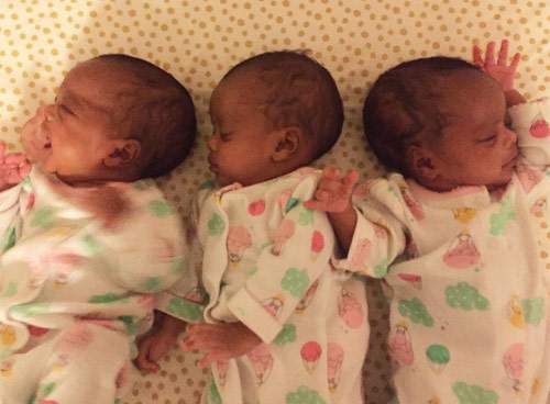 Ca sinh 3 bé gái da màu giống hệt nhau "yêu không tả nổi" 12