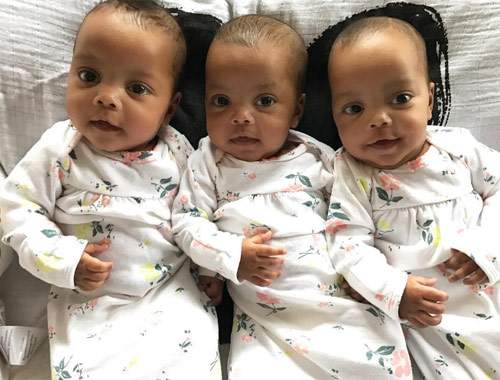 Ca sinh 3 bé gái da màu giống hệt nhau "yêu không tả nổi" 18