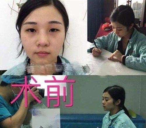 Bác sĩ 8 năm sửa mặt cho cô gái thành Phạm Băng Băng rồi yêu luôn bệnh nhân của mình 6
