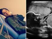 Những vị trí nằm “oái oăm” của thai nhi trong bụng mẹ 14