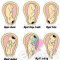 Những vị trí nằm “oái oăm” của thai nhi trong bụng mẹ 13