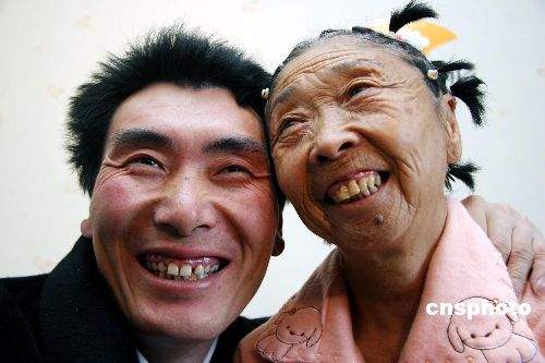 Cụ bà 71 tuổi quyết phẫu thuật thẩm mỹ để đẹp đôi với người tình 32 tuổi 18
