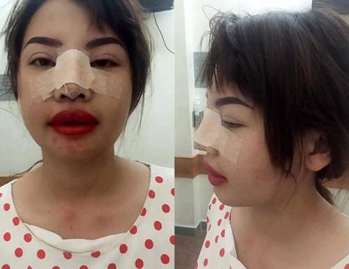 Cô gái Đăk Nông từng khốn khổ vì bị chê xấu nay đã lột xác ngoạn mục sau 1 tháng 6