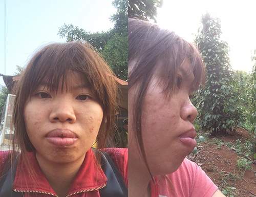 Cô gái Đăk Nông từng khốn khổ vì bị chê xấu nay đã lột xác ngoạn mục sau 1 tháng 3
