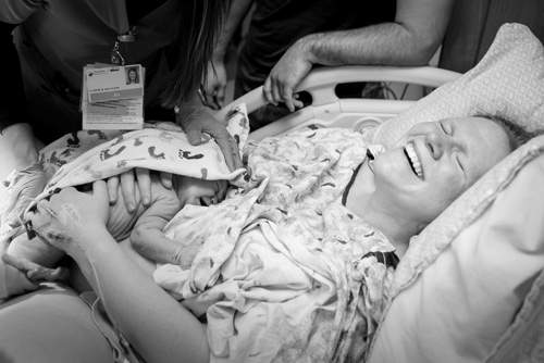 Ca sinh em bé bị dây rốn siết chặt méo bụng khiến bác sĩ kinh ngạc 6