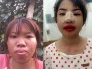Cô gái 9x Hà Nội khiến ai cũng ngỡ ngàng vì diện mạo xinh đẹp sau thẩm mỹ 49