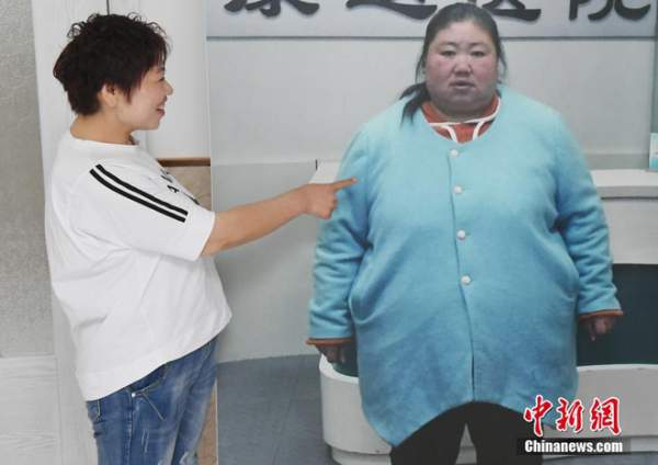Bị chồng bỏ, cô nàng Trung Quốc giảm 121 kg và nhận "quả ngọt"