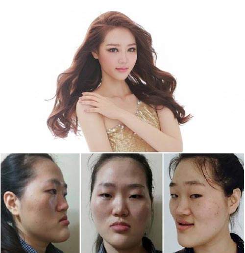 Vỡ mộng khi ngắm "mặt nguyên thủy" của loạt gái đẹp Hàn 9
