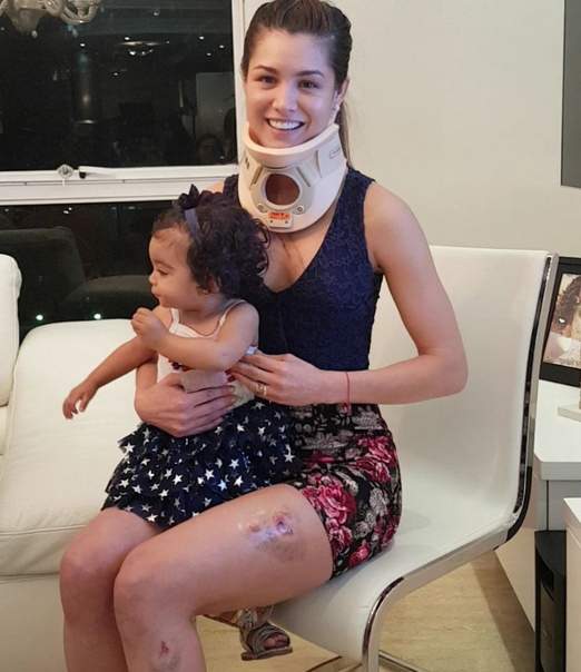 Hỗn chiến hoa hậu Venezuela bị nữ ca sĩ đánh trọng thương 2