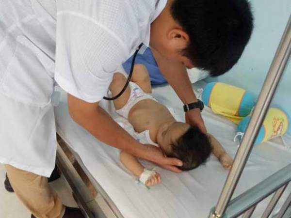 Bé trai 14 tháng tuổi bị bạo hành dã man ở Hà Nội được xuất viện 2