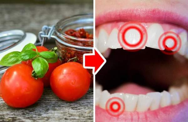 9 loại thực phẩm hay ăn hằng ngày có hại cho răng ít người biết 6