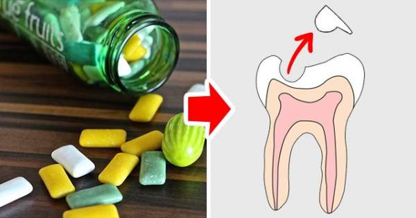 9 loại thực phẩm hay ăn hằng ngày có hại cho răng ít người biết 5